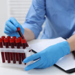 A Blood Test That Can Reveal How Fast Your Organs Are Aging — What It Means for Every American